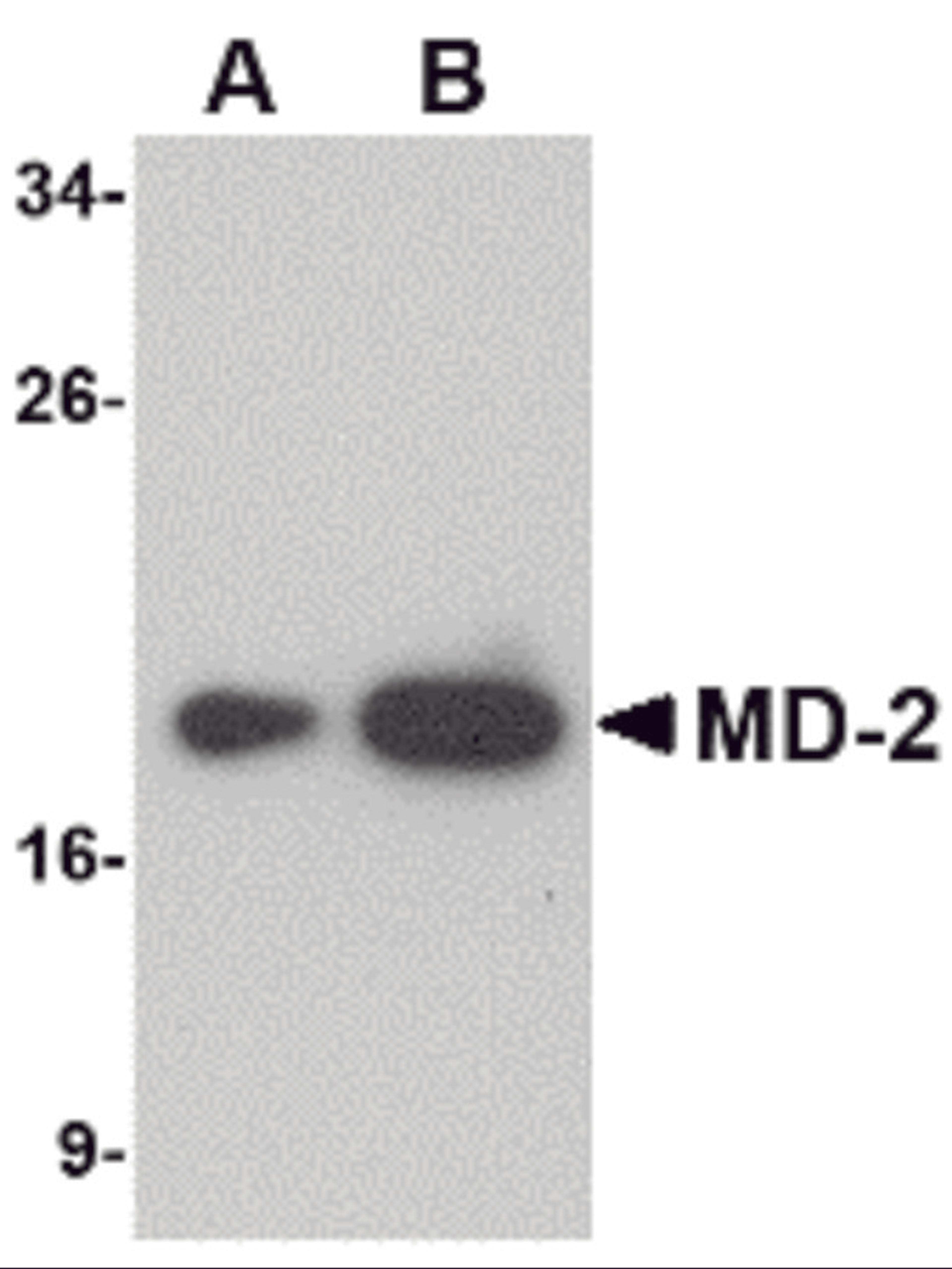 Western blot analysis of (A) 25 and (B) 125 ng of MD-2 recombinant protein with MD-2 antibody at 1 μg/mL.
