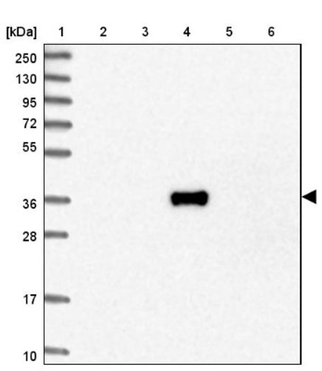 Western Blot: MANSC4 Antibody [NBP2-32618] - Lane 1: Marker [kDa] 250, 130, 95, 72, 55, 36, 28, 17, 10<br/>Lane 2: Human cell line RT-4<br/>Lane 3: Human cell line U-251MG sp<br/>Lane 4: Human plasma (IgG/HSA depleted)<br/>Lane 5: Human liver tissue<br/>Lane 6: Human tonsil tissue