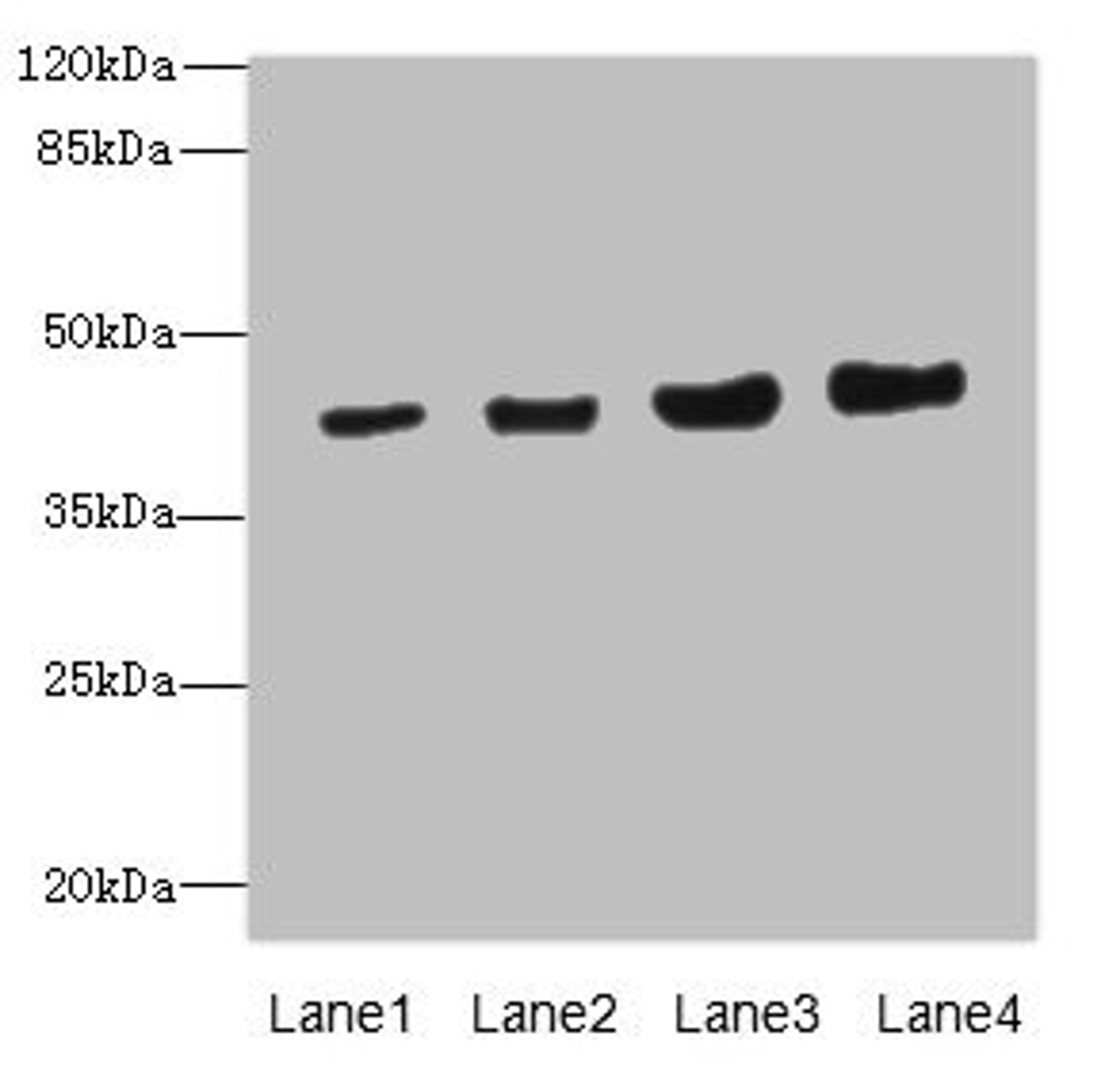 Western blot. All lanes: PPM1A antibody at 6.88µg/ml. Lane 1: HepG2 whole cell lysate. Lane 2: SH-SY5Y whole cell lysate. Lane 3: Mouse liver tissue. Lane 4: Mouse brain tissue. Secondary. Goat polyclonal to rabbit IgG at 1/10000 dilution. Predicted band size: 43, 36, 52 kDa. Observed band size: 43 kDa