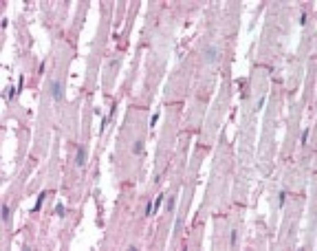 Immunohistochemistry-Paraffin: ATG4B Antibody [NBP2-24709] - IHC analysis of human heart using NBP2-24709 at 10 ug/ml.