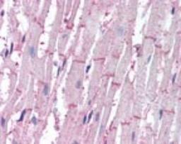 Immunohistochemistry-Paraffin: ATG4B Antibody [NBP2-24709] - IHC analysis of human heart using NBP2-24709 at 10 ug/ml.