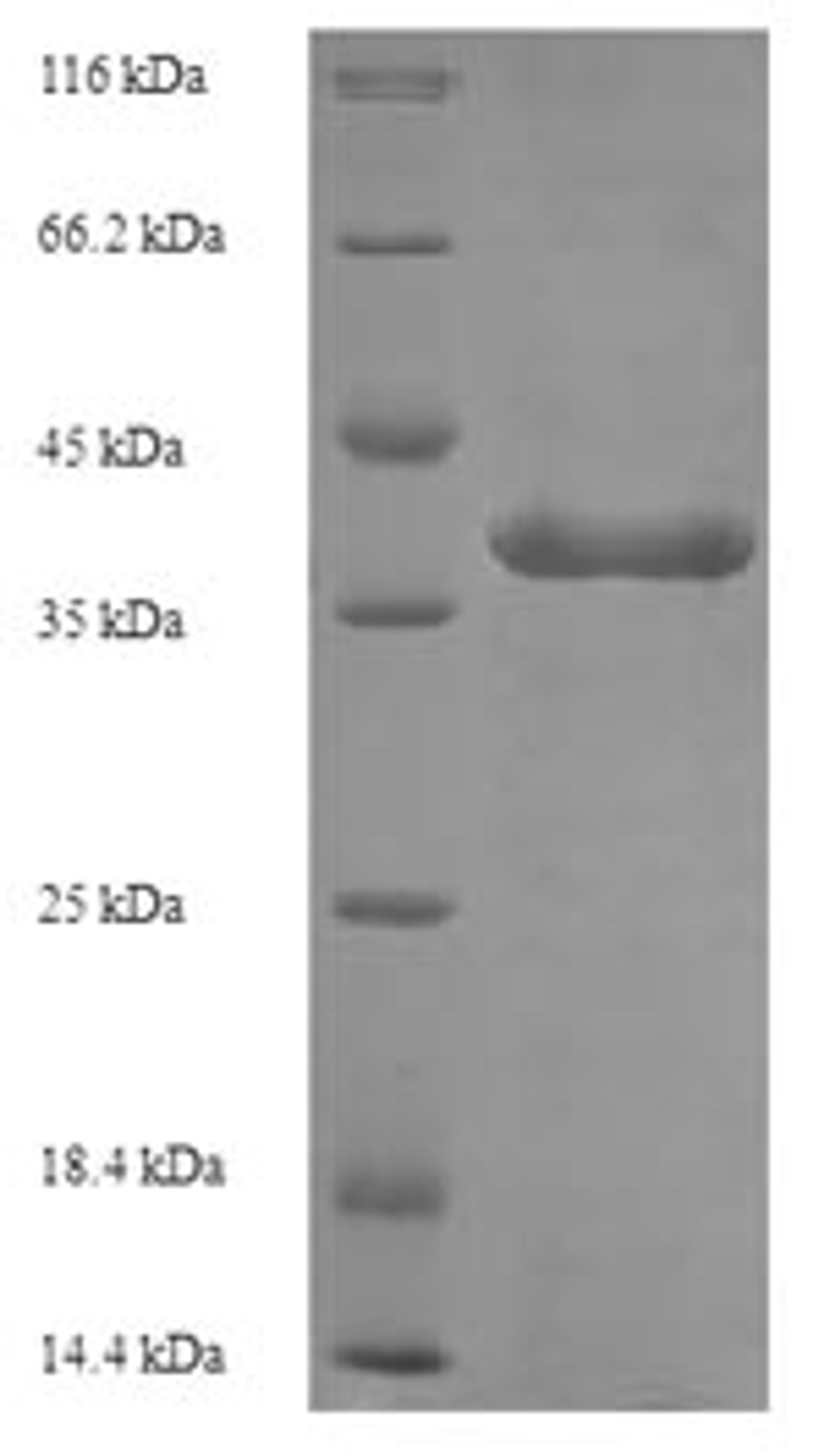 (Tris-Glycine gel) Discontinuous SDS-PAGE (reduced) with 5% enrichment gel and 15% separation gel.