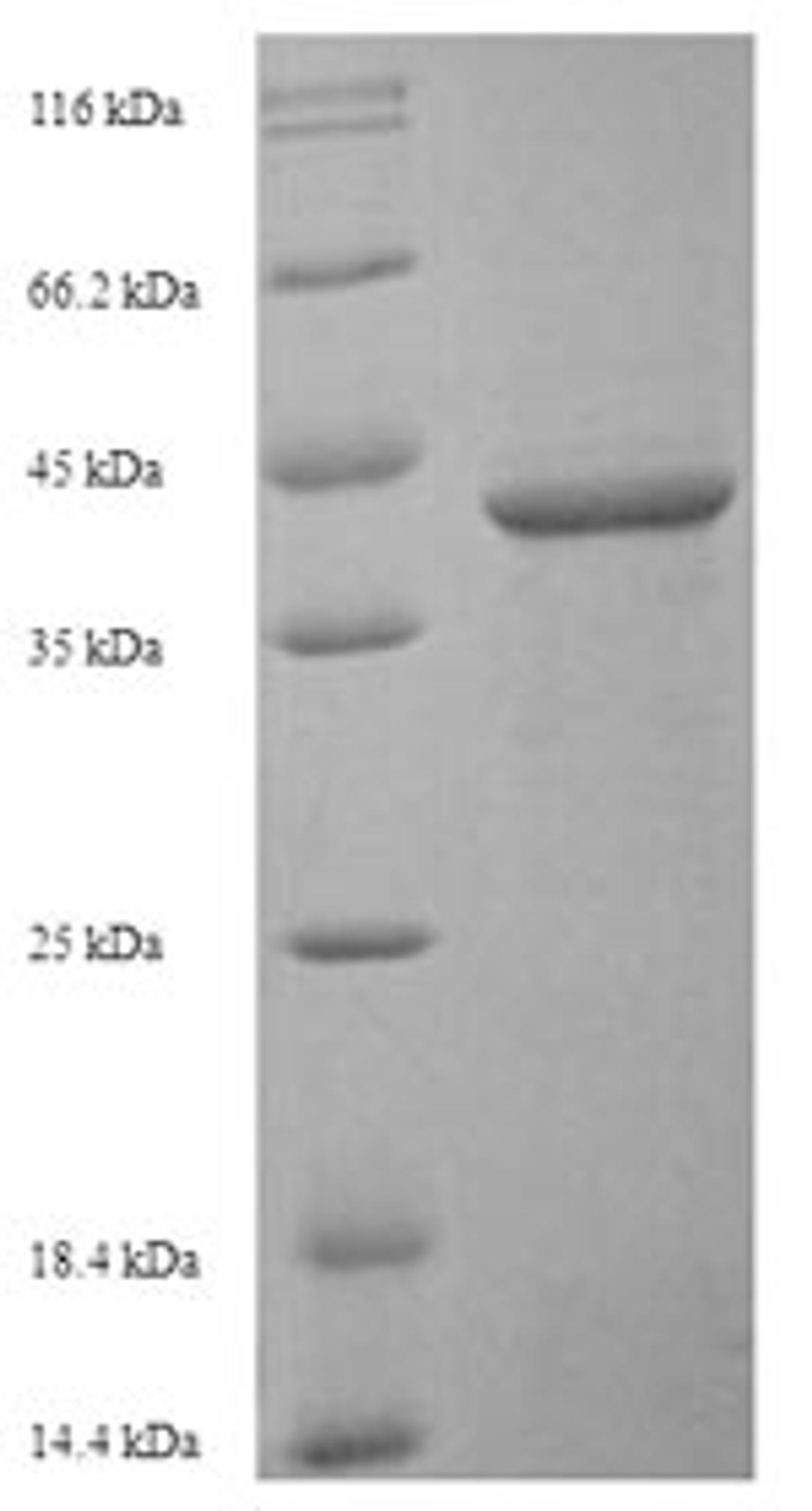 (Tris-Glycine gel) Discontinuous SDS-PAGE (reduced) with 5% enrichment gel and 15% separation gel.