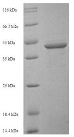 (Tris-Glycine gel) Discontinuous SDS-PAGE (reduced) with 5% enrichment gel and 15% separation gel.