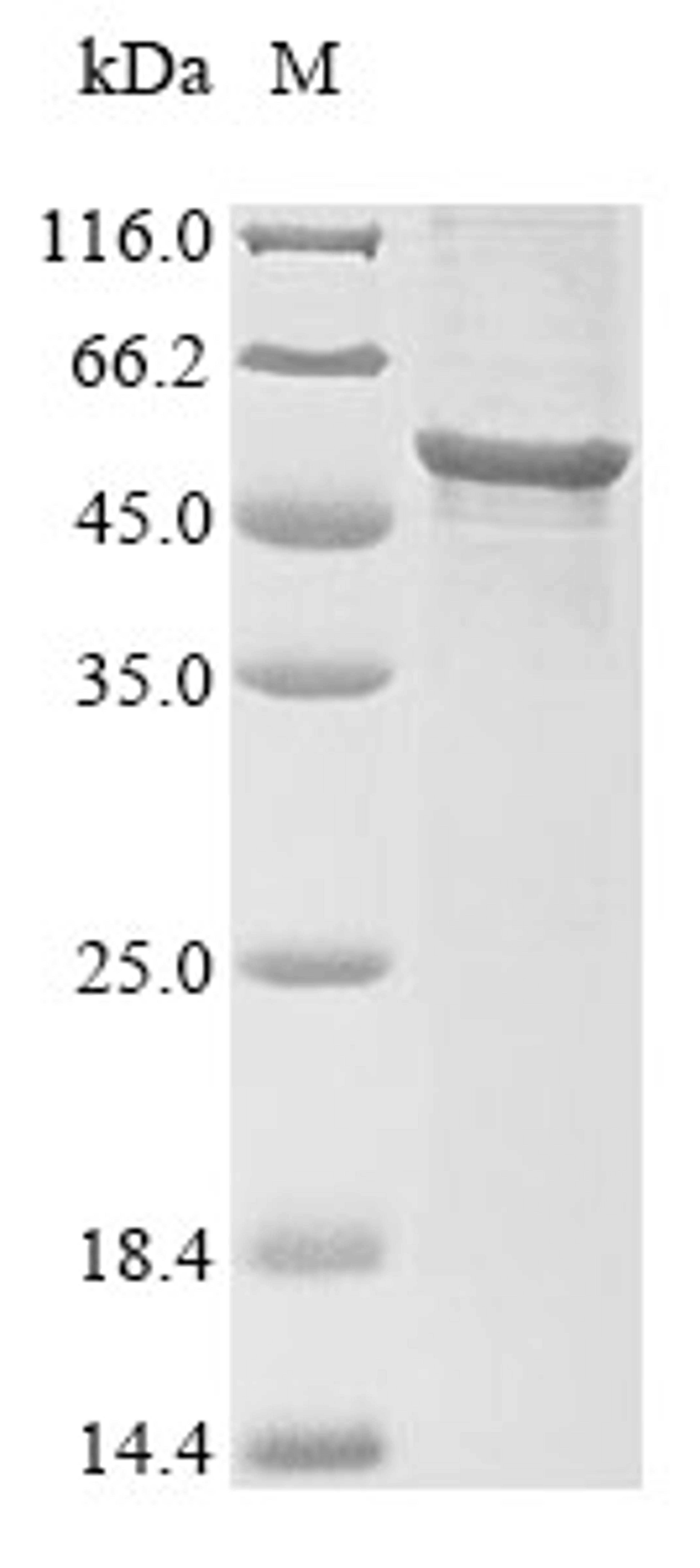 (Tris-Glycine gel) Discontinuous SDS-PAGE (reduced) with 5% enrichment gel and 15% separation gel.