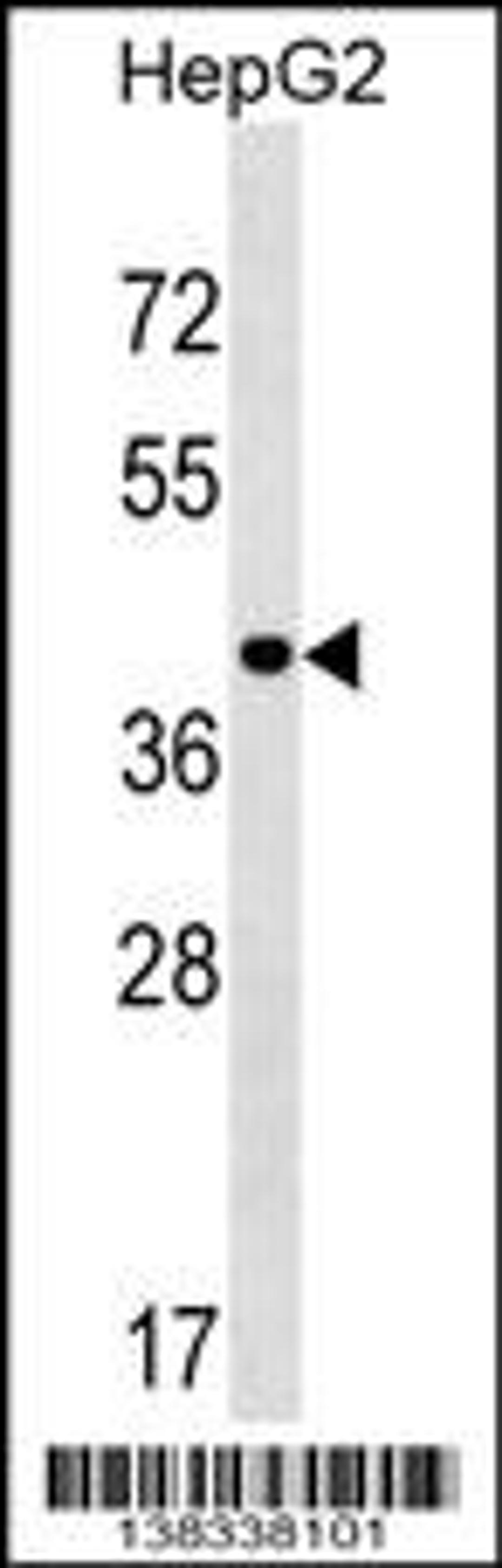 Western blot analysis in HepG2 cell line lysates (35ug/lane).