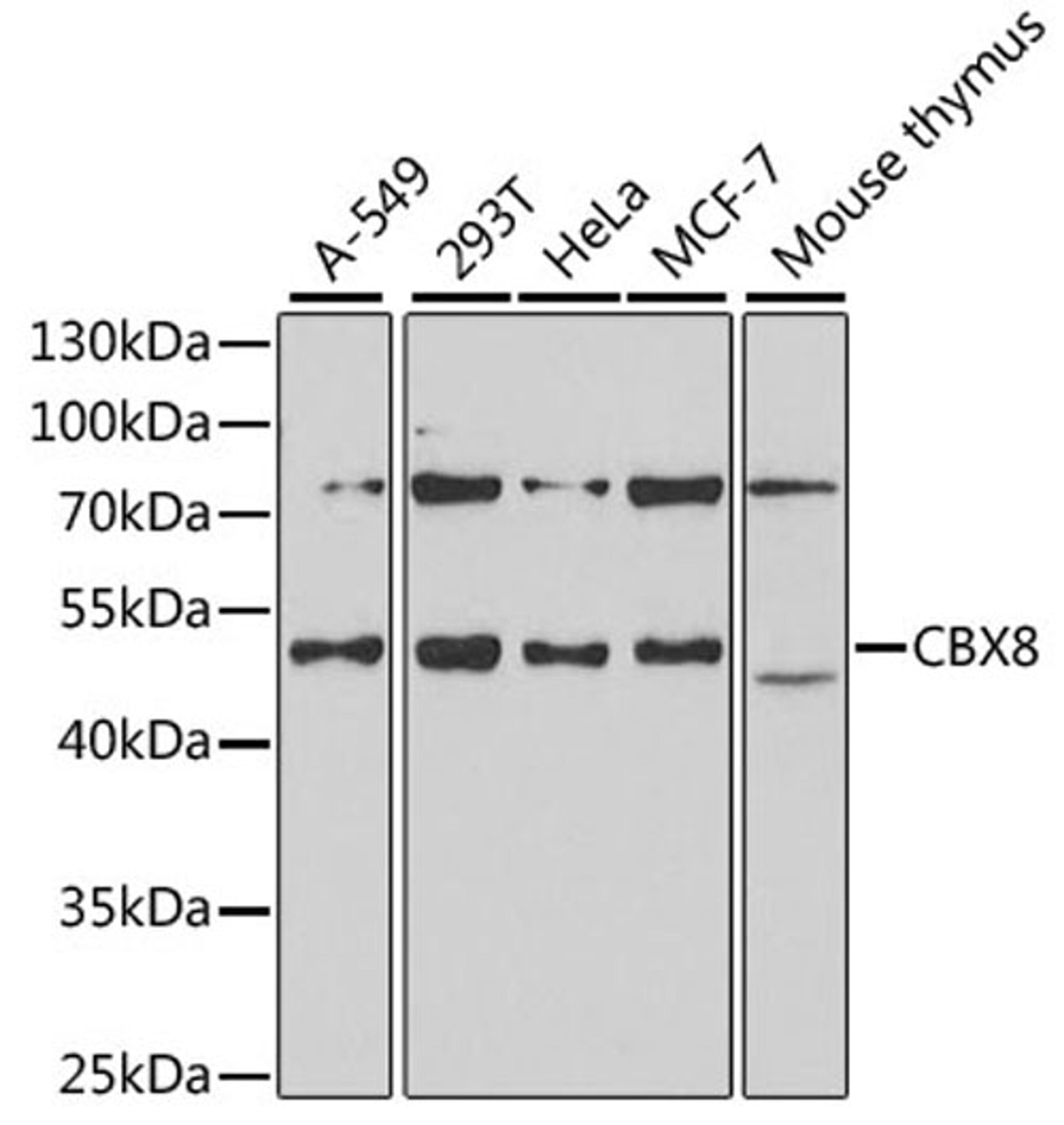 Western blot - CBX8 antibody (A6222)