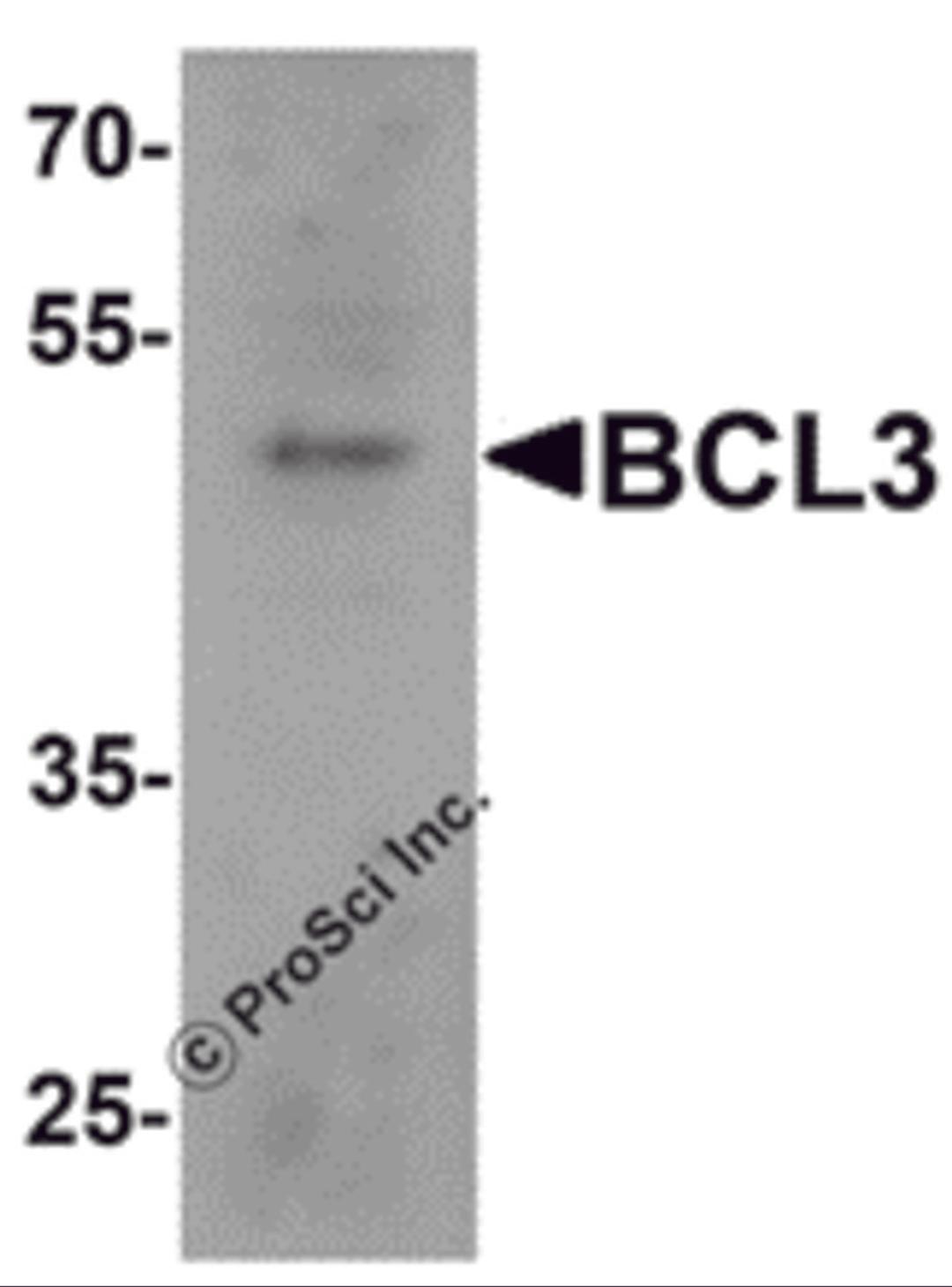 Western blot analysis of BCL3 in 293 cell lysate with BCL3 antibody at 1 μg/mL.