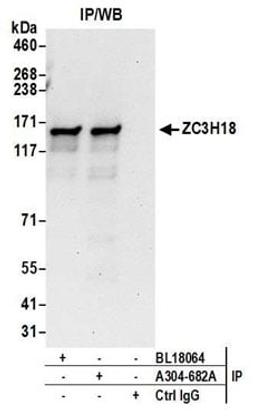 Detection of human ZC3H18 by western blot of immunoprecipitates.