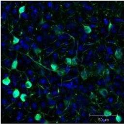 Immunofluorescence analysis of Mouse brain tissue using GFP (GOAT) antibody (Biotin)