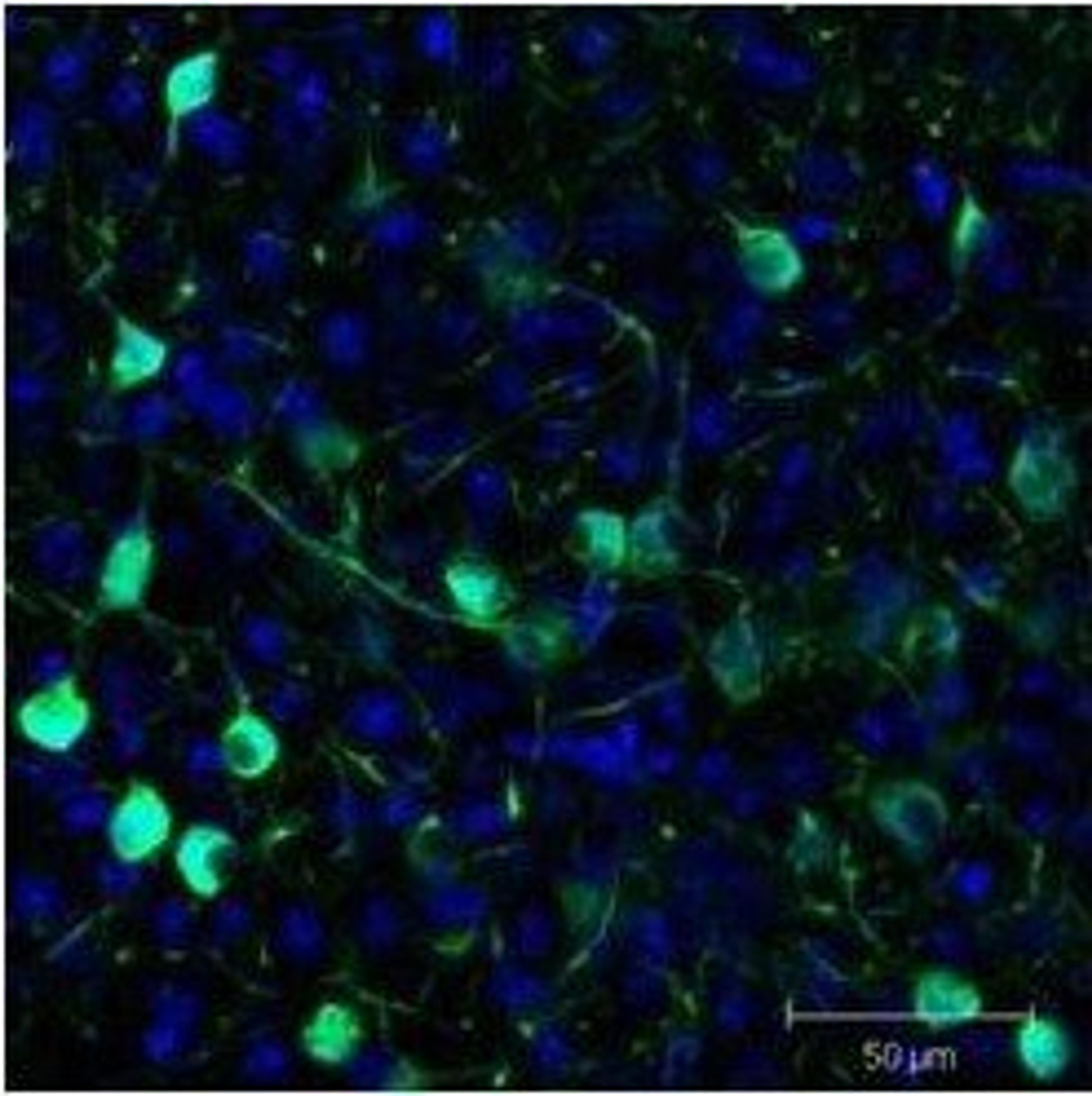 Immunofluorescence analysis of Mouse brain tissue using GFP (GOAT) antibody (Biotin)