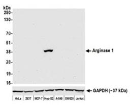 Detection of human Arginase 1 by western blot.