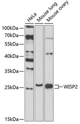 Western blot - WISP2 antibody (A7456)