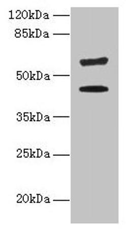 Western blot. All lanes: KRT73 antibody at 4µg/ml + HepG2 whole cell lysate. Secondary. Goat polyclonal to rabbit IgG at 1/10000 dilution. Predicted band size: 59, 42 kDa. Observed band size: 59, 42 kDa