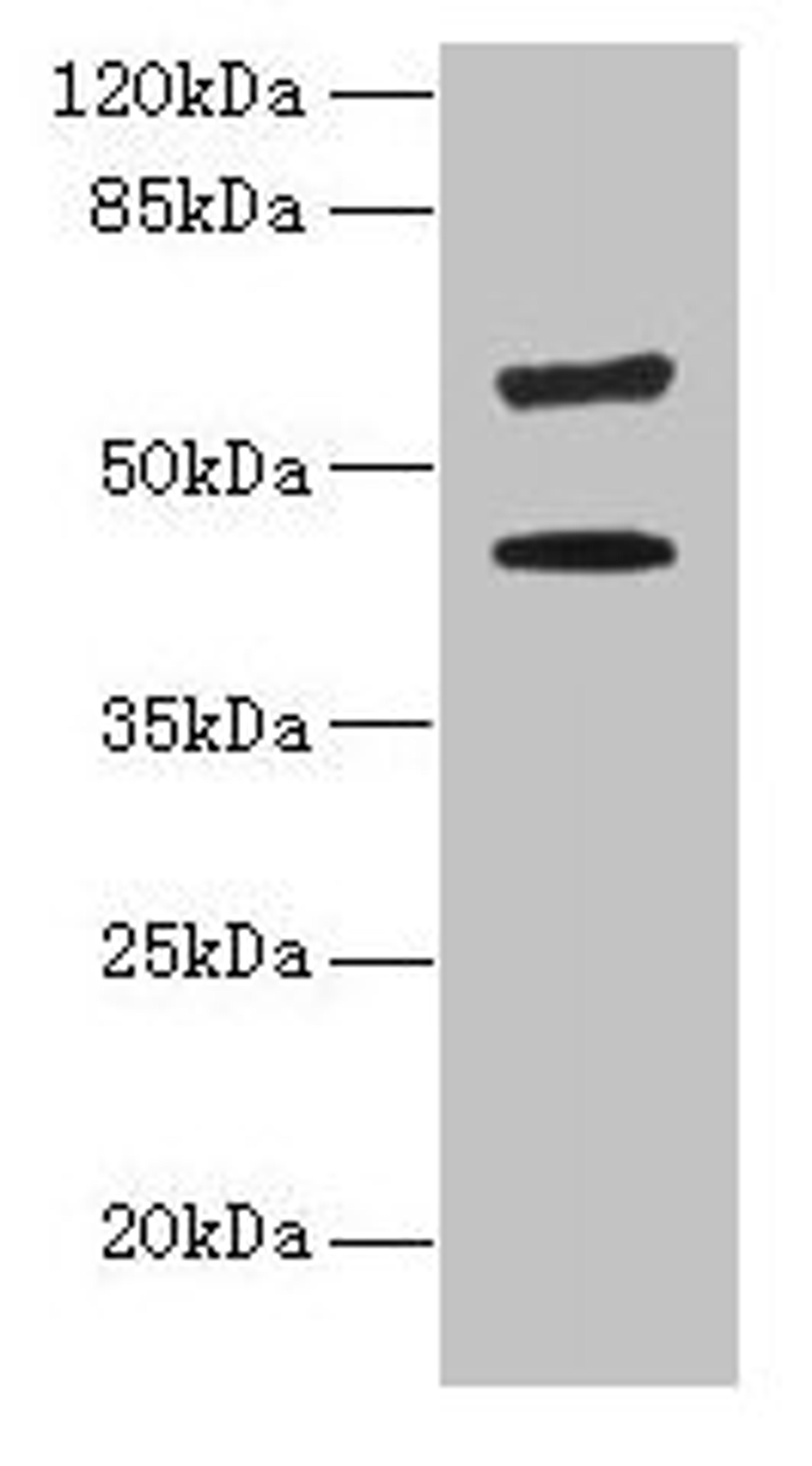 Western blot. All lanes: KRT73 antibody at 4µg/ml + HepG2 whole cell lysate. Secondary. Goat polyclonal to rabbit IgG at 1/10000 dilution. Predicted band size: 59, 42 kDa. Observed band size: 59, 42 kDa