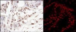 Detection of human SART3/TIP110 by immunohistochemistry and Immunofluorescence.