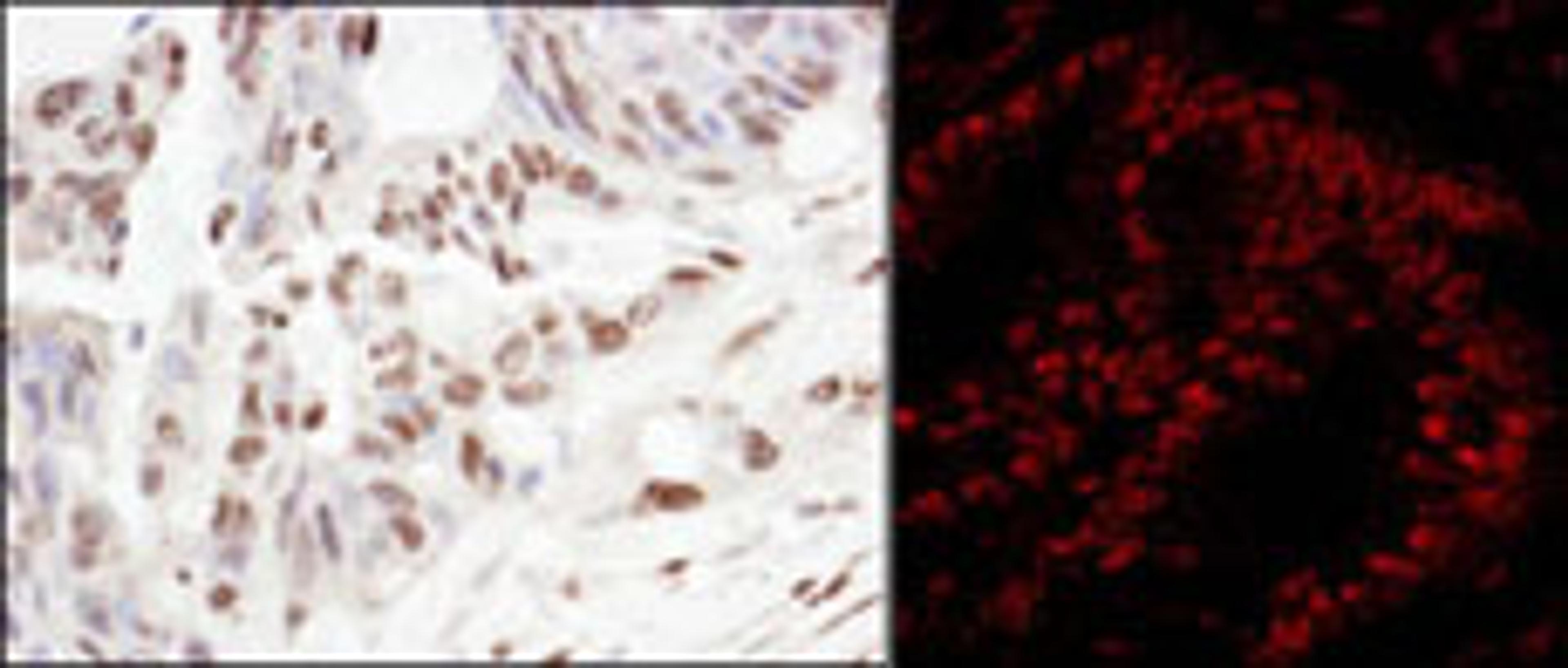 Detection of human SART3/TIP110 by immunohistochemistry and Immunofluorescence.