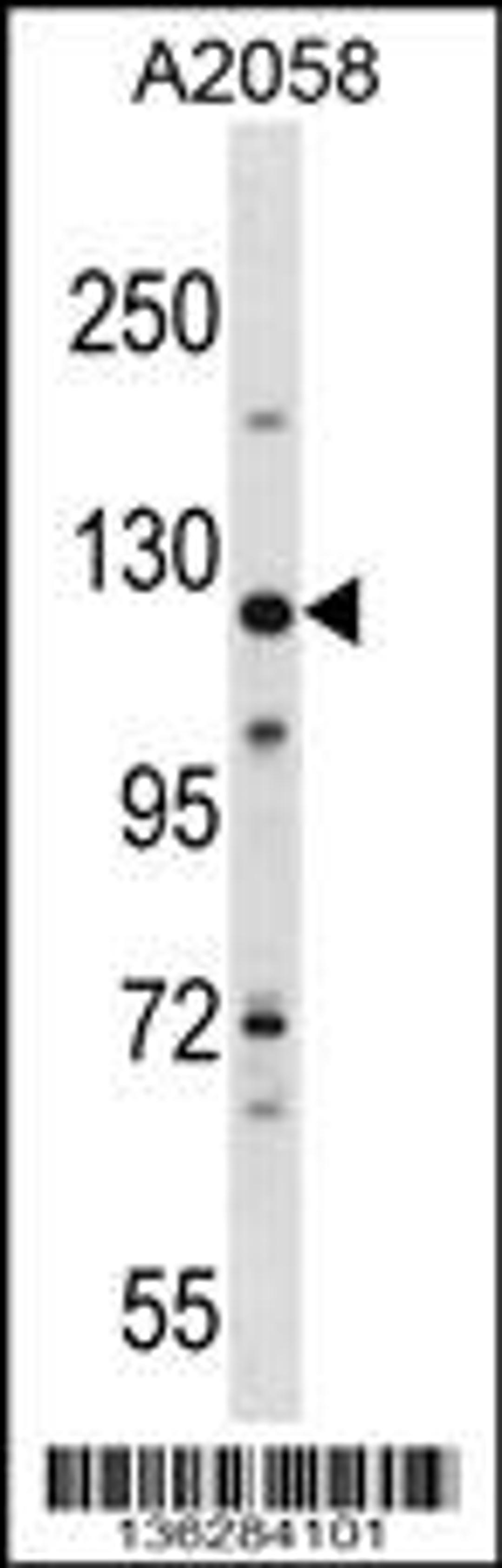 Western blot analysis in A2058 cell line lysates (35ug/lane).