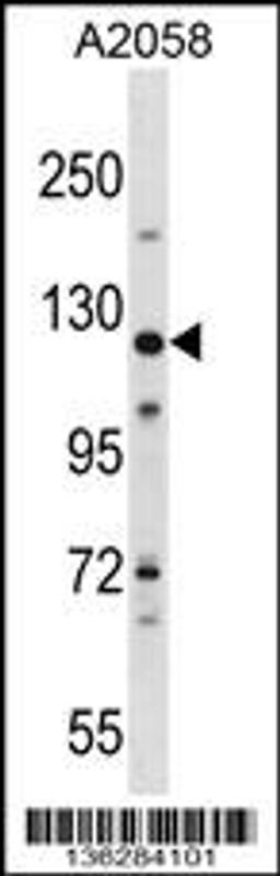 Western blot analysis in A2058 cell line lysates (35ug/lane).