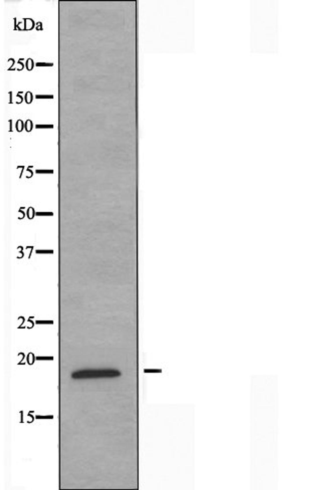 Western blot analysis of A549 cells using Myelodysplasia Syndrome 1 antibody