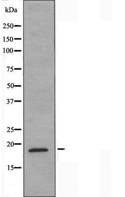 Western blot analysis of A549 cells using Myelodysplasia Syndrome 1 antibody