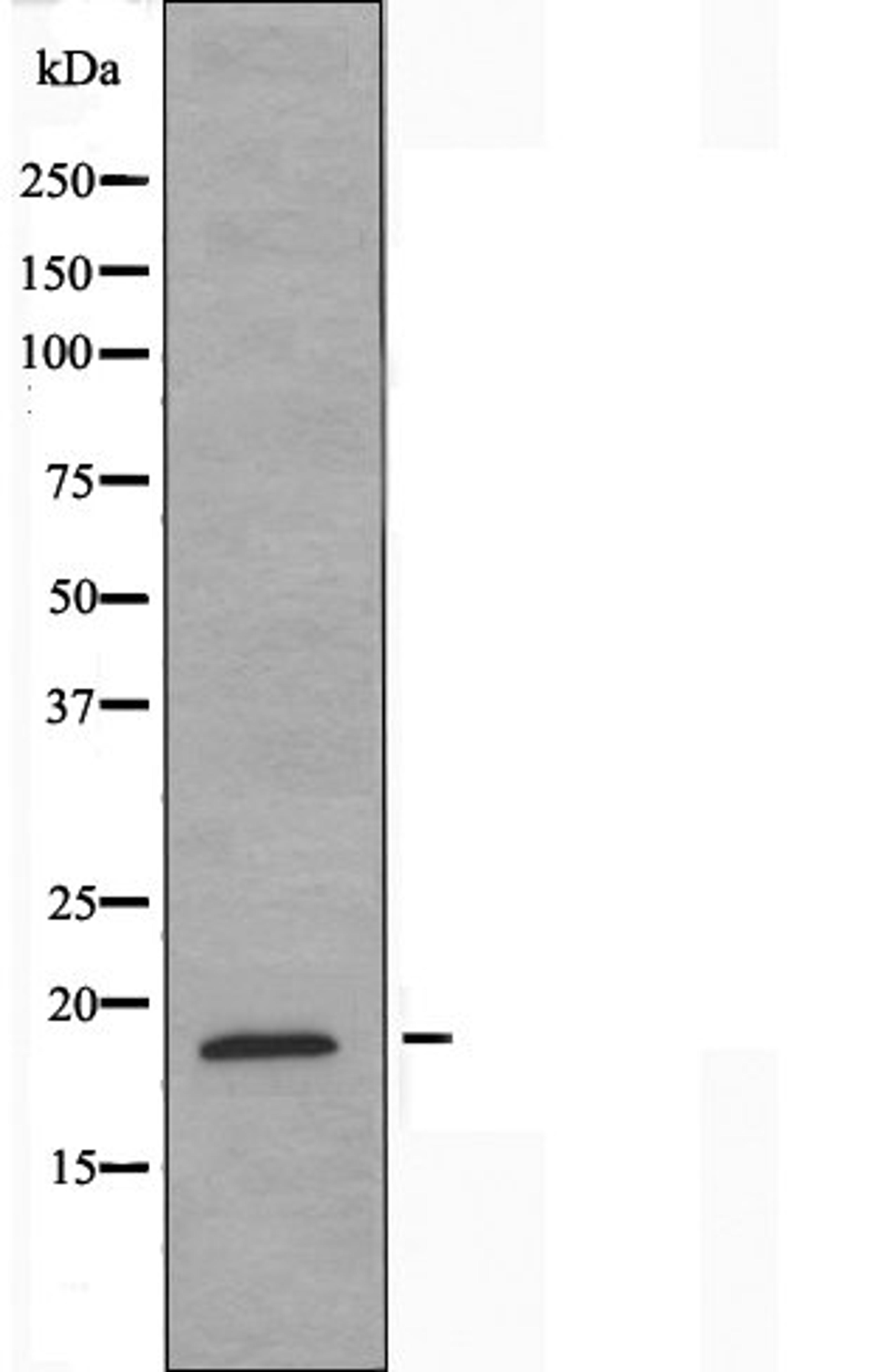 Western blot analysis of A549 cells using Myelodysplasia Syndrome 1 antibody