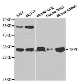 Western blot analysis of extracts of various cell lines using TFPI antibody