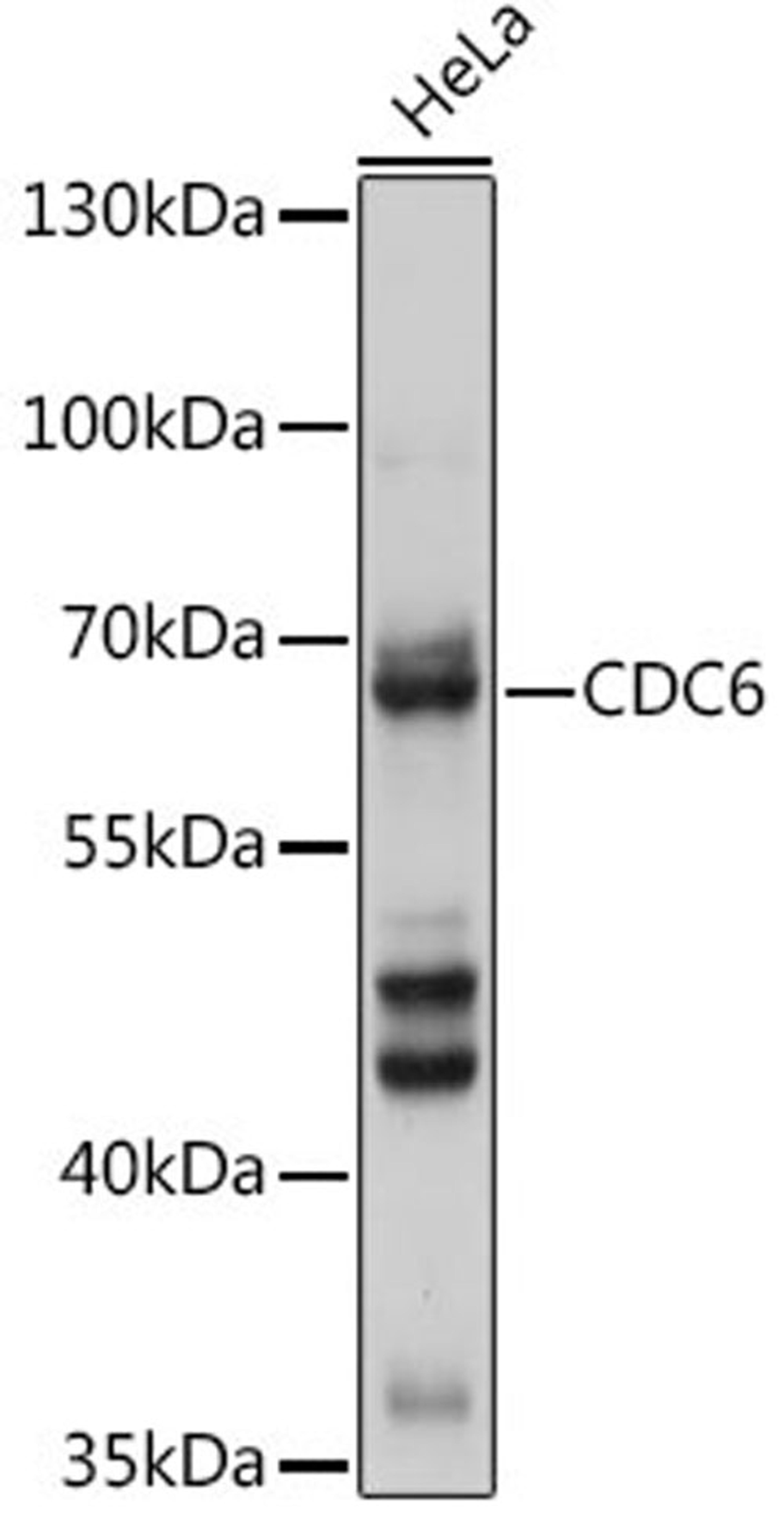 Western blot - CDC6 antibody (A18249)