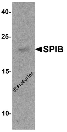 Western blot analysis of SPIB in human prostate tissue lysate with SPIB antibody at 1 μg/ml.