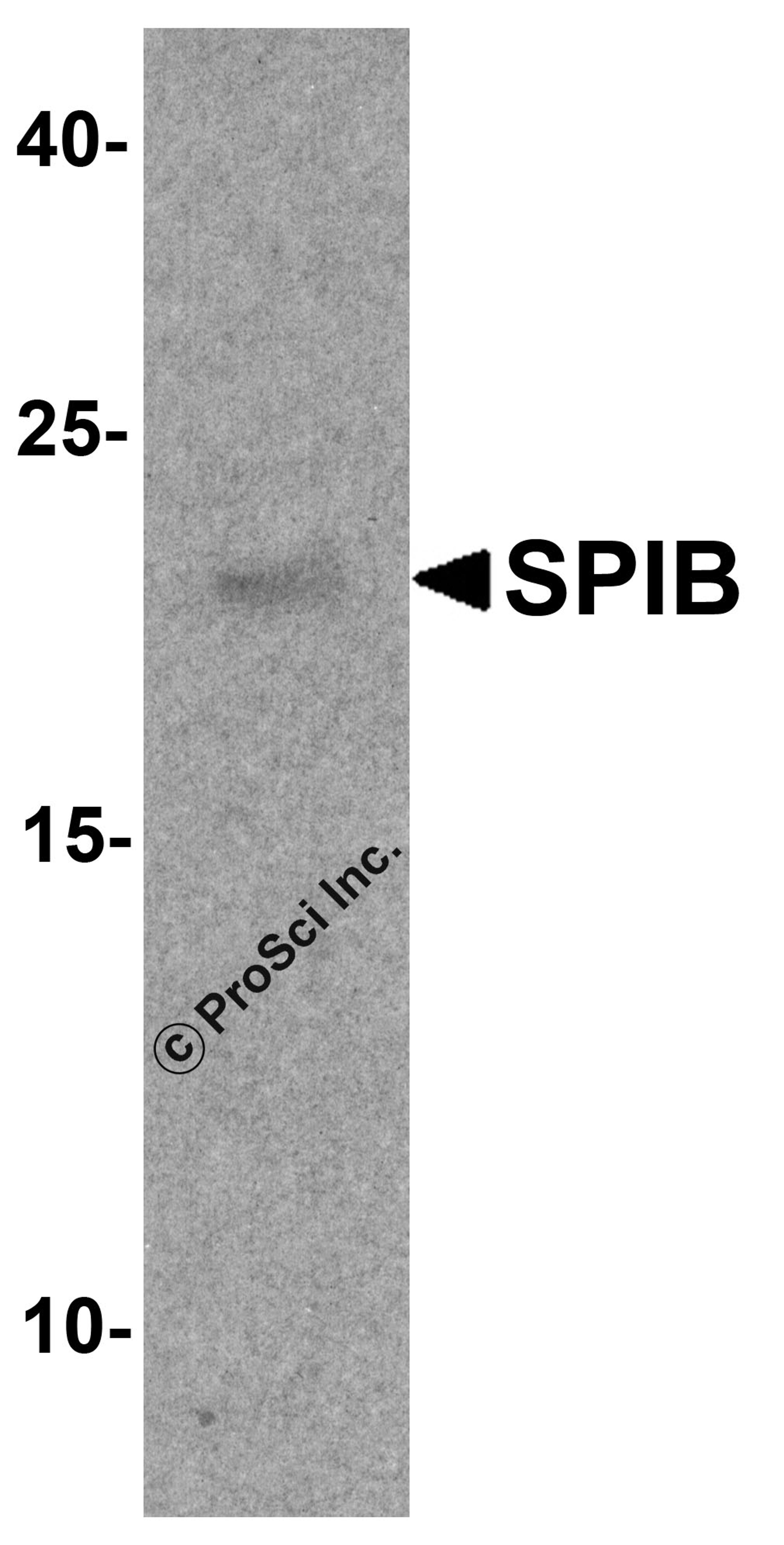 Western blot analysis of SPIB in human prostate tissue lysate with SPIB antibody at 1 μg/ml.