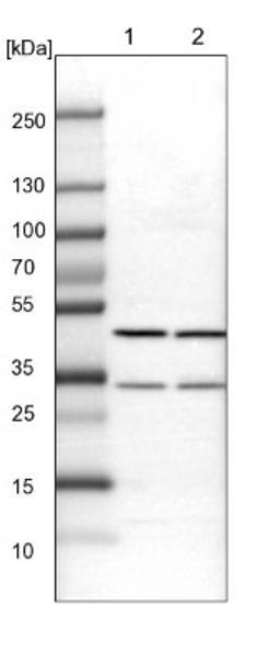 Western Blot: BHMT2 Antibody [NBP1-85826] - Lane 1: Mouse liver tissue lysate<br/>Lane 2: Rat liver tissue lysate