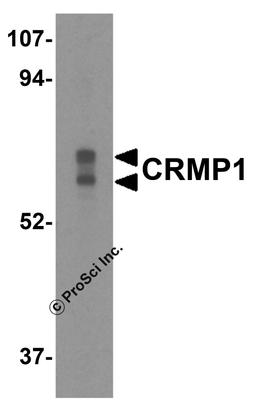 Western blot analysis of CRMP1 in Caco-2 cell lysate with CRMP1 antibody at 0.5 μg/mL.