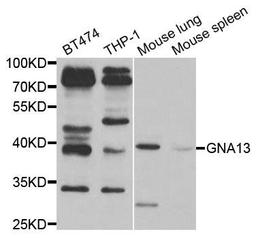 Western blot analysis of extracts of various cell lines using GNA13 antibody