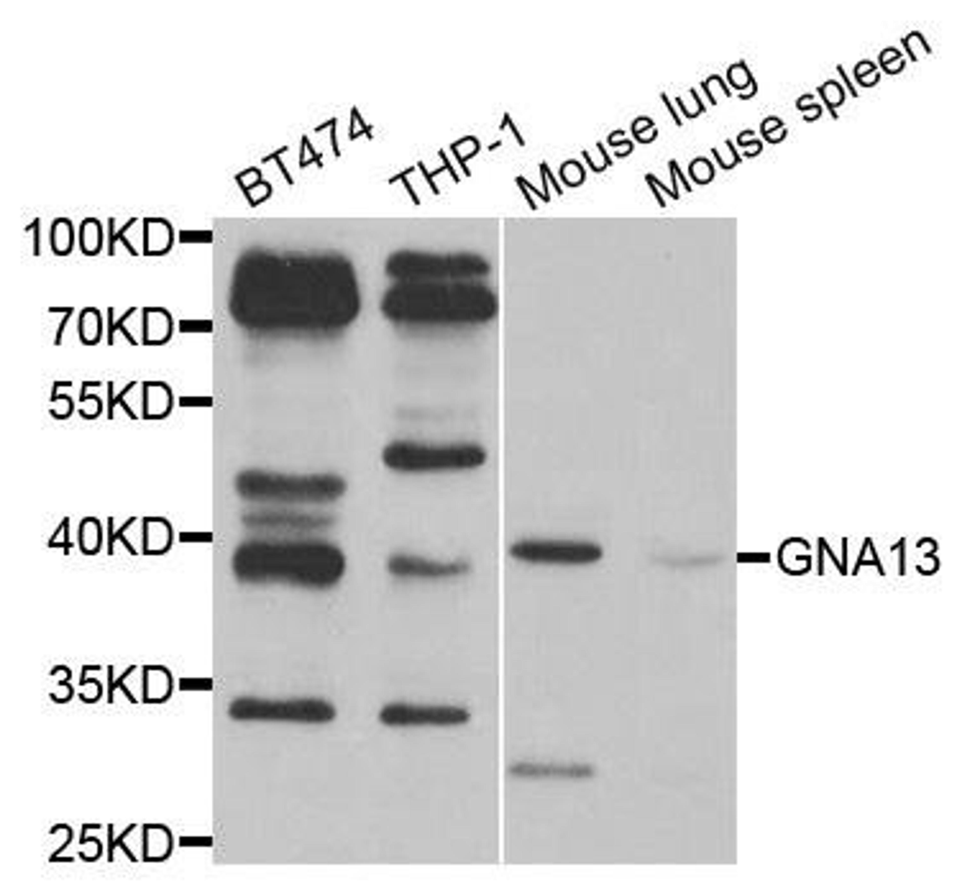 Western blot analysis of extracts of various cell lines using GNA13 antibody