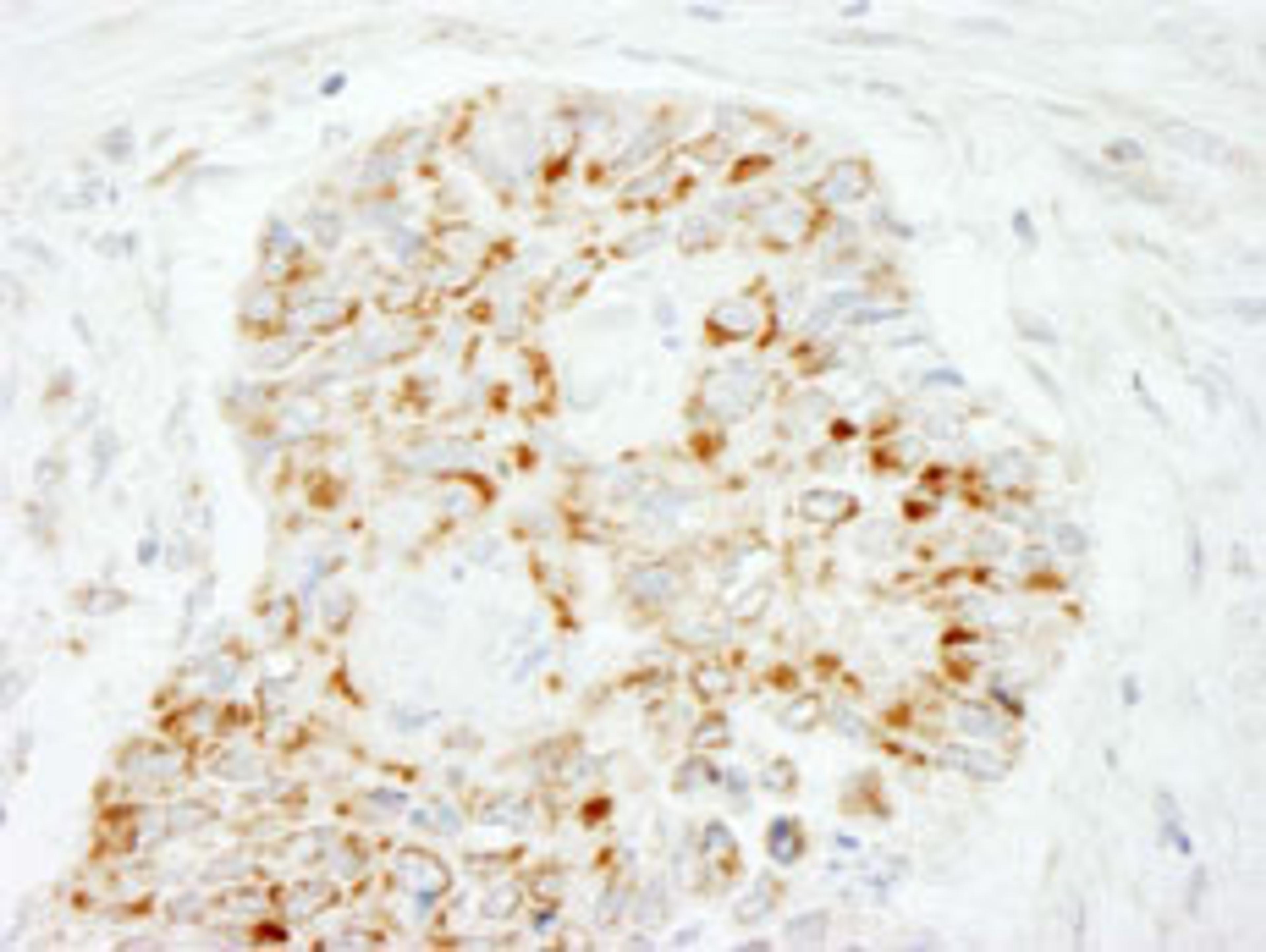 Detection of human MAVS/VISA by immunohistochemistry.