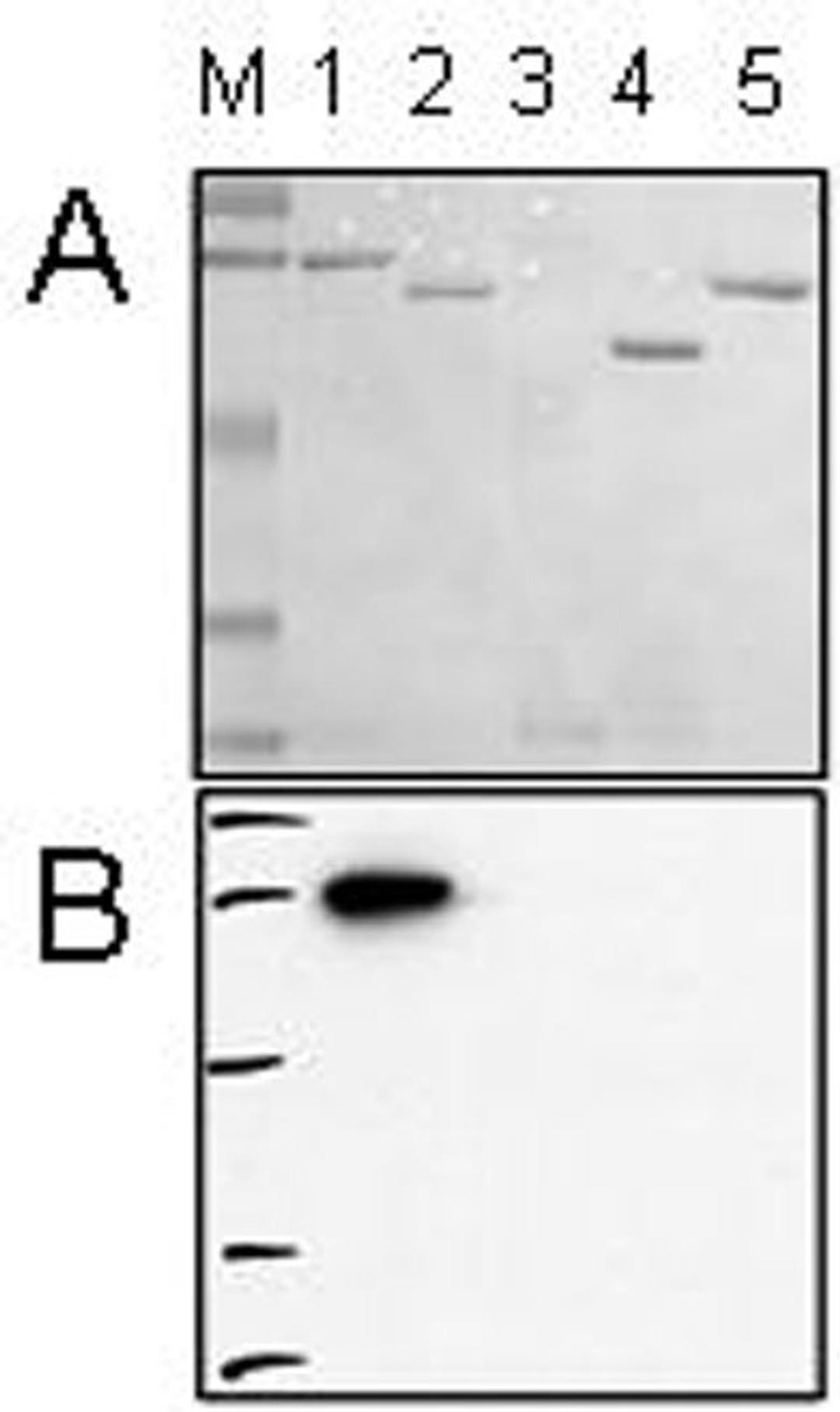 A. Ponceau staining of protein kinases. B. Western Blot analysis showing a single band with AKT1