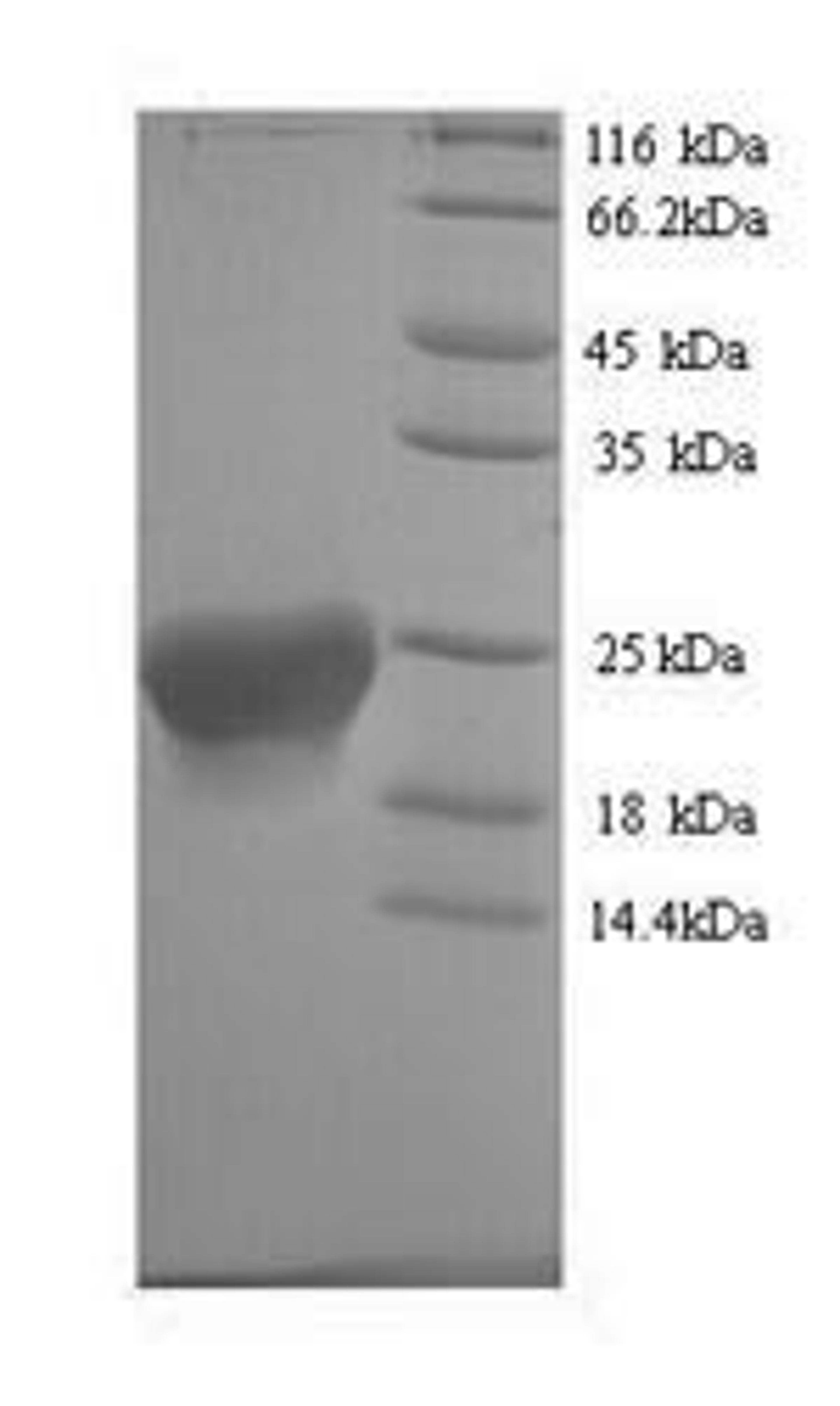 (Tris-Glycine gel) Discontinuous SDS-PAGE (reduced) with 5% enrichment gel and 15% separation gel.
