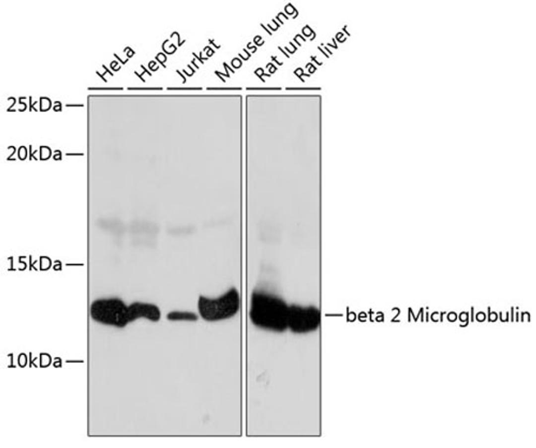 Western blot - beta 2 Microglobulin Rabbit mAb (A11642)