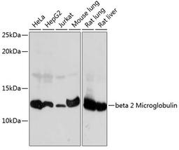 Western blot - beta 2 Microglobulin Rabbit mAb (A11642)