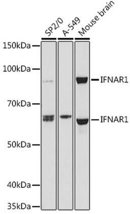 Western blot - IFNAR1 antibody (A18594)