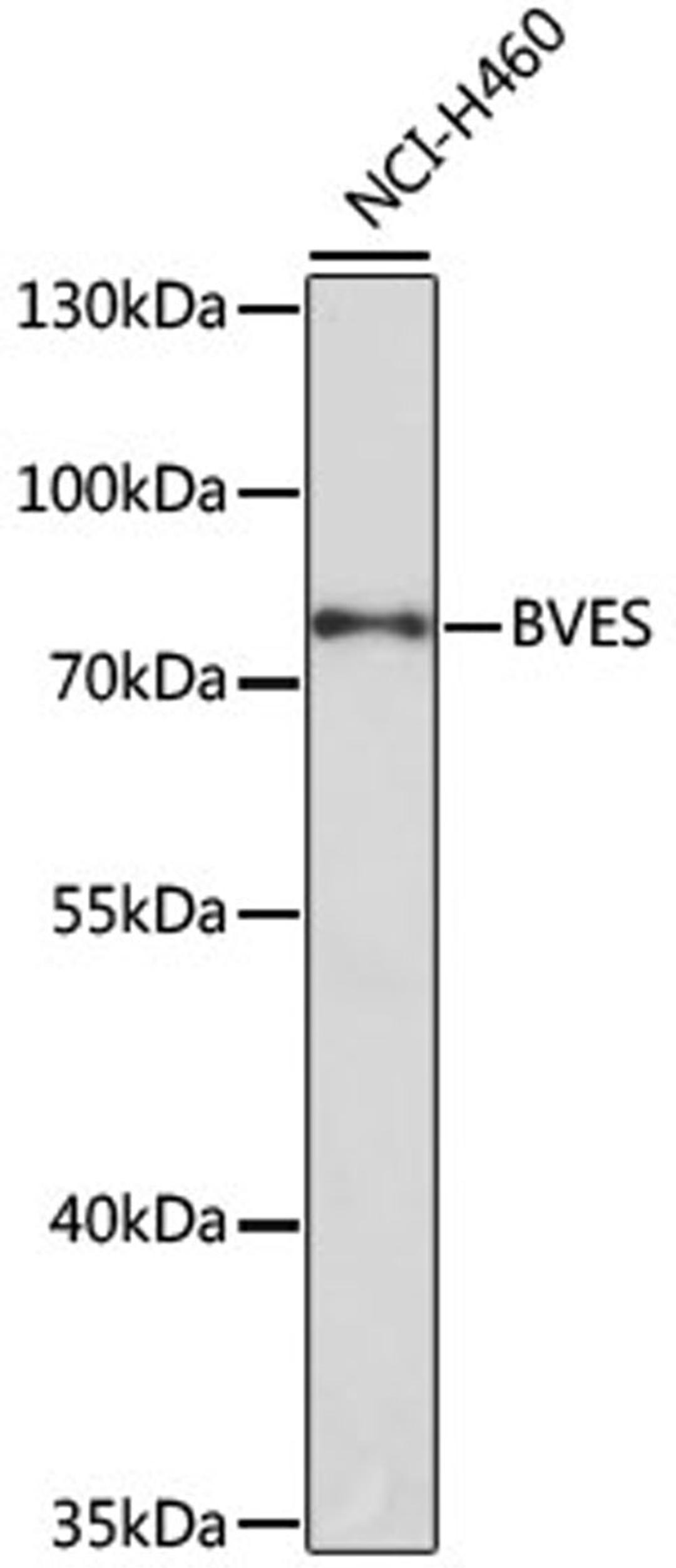 Western blot - BVES antibody (A0213)