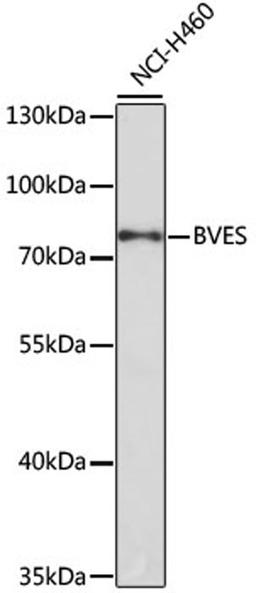 Western blot - BVES antibody (A0213)