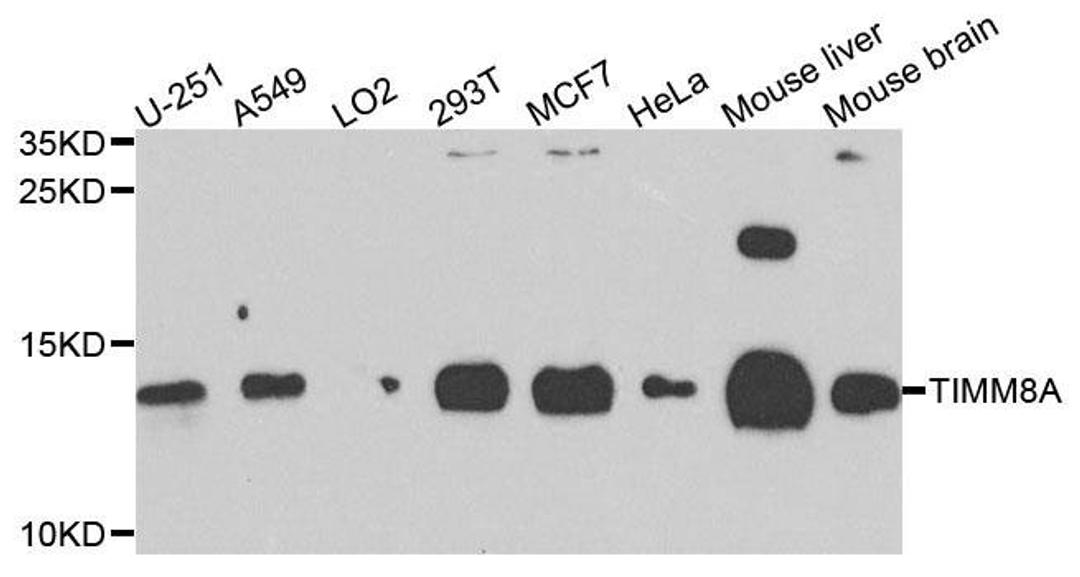 Western blot analysis of extracts of various cells using TIMM8A antibody