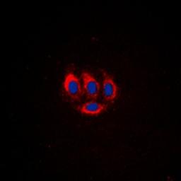 Immunofluorescense analysis of HeLa cells using BMX (phospho-Y566) antibody