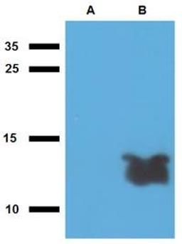 WB analysis of cell lysate of non-transfected E. coli (Lane1), cell lysate of Acr1-transfected E. coli (Lane2) using Tb7.7 antibody