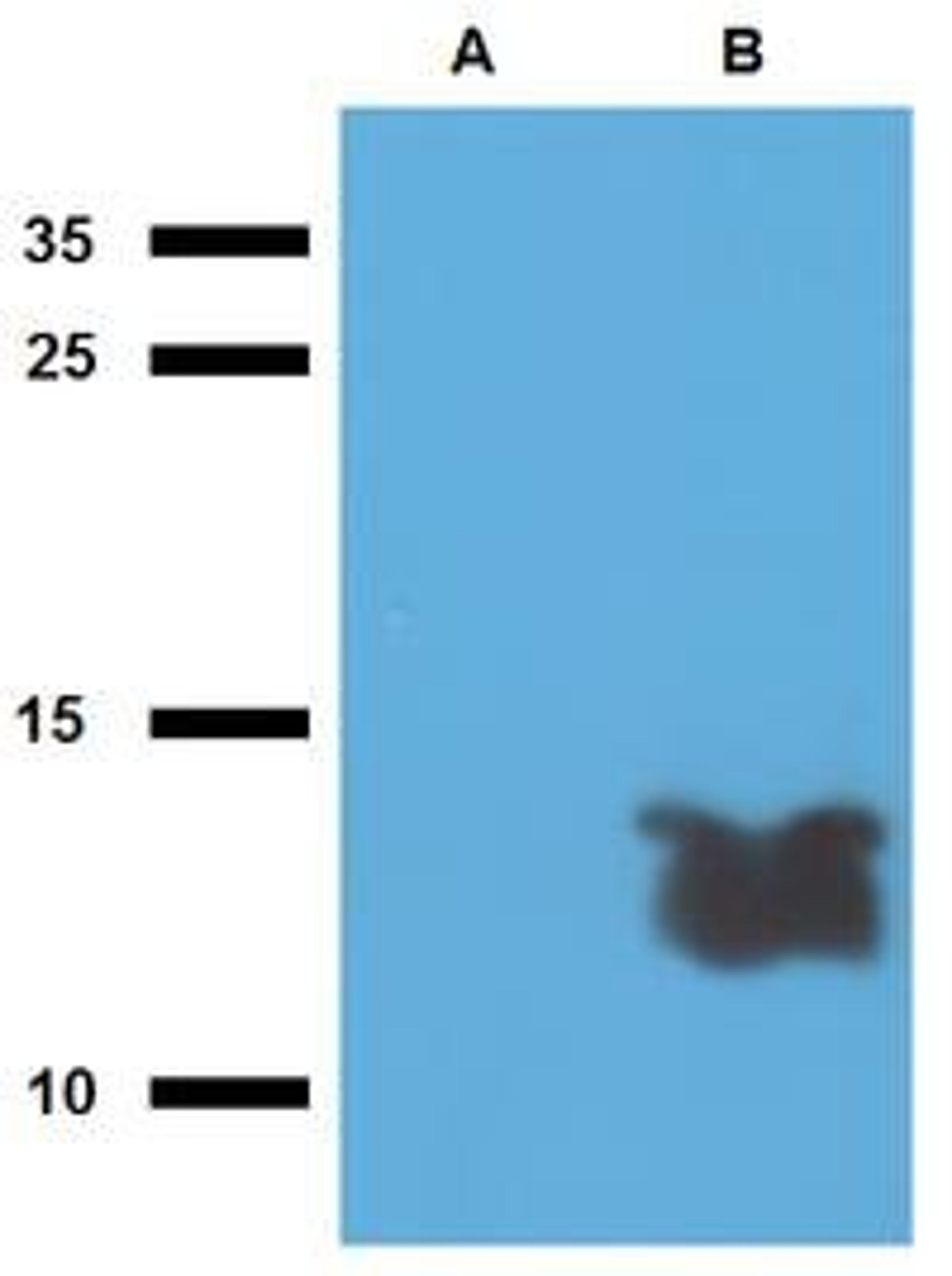 WB analysis of cell lysate of non-transfected E. coli (Lane1), cell lysate of Acr1-transfected E. coli (Lane2) using Tb7.7 antibody