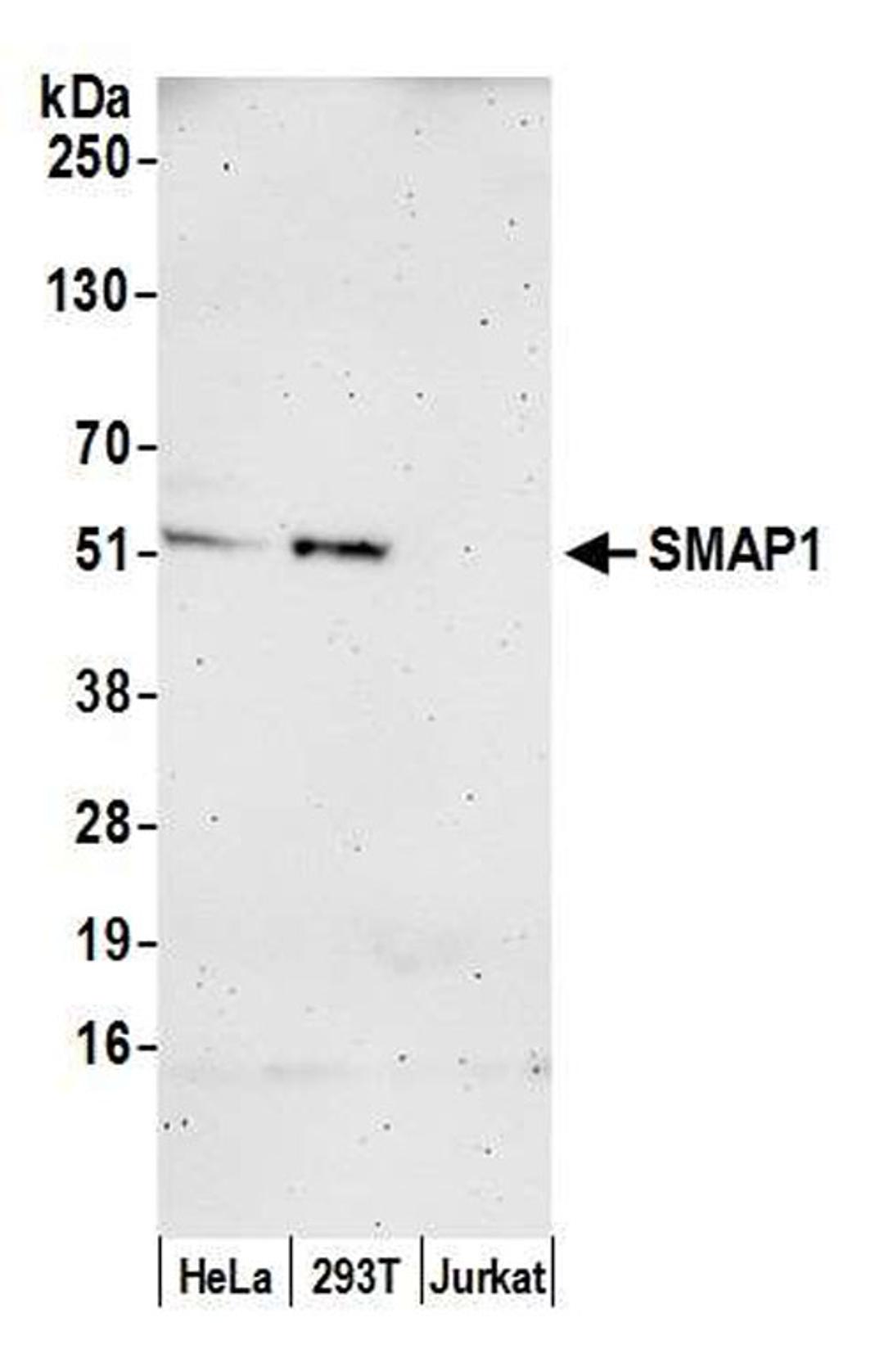 Detection of human SMAP1 by WB.