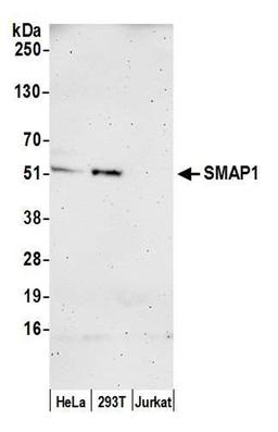 Detection of human SMAP1 by WB.