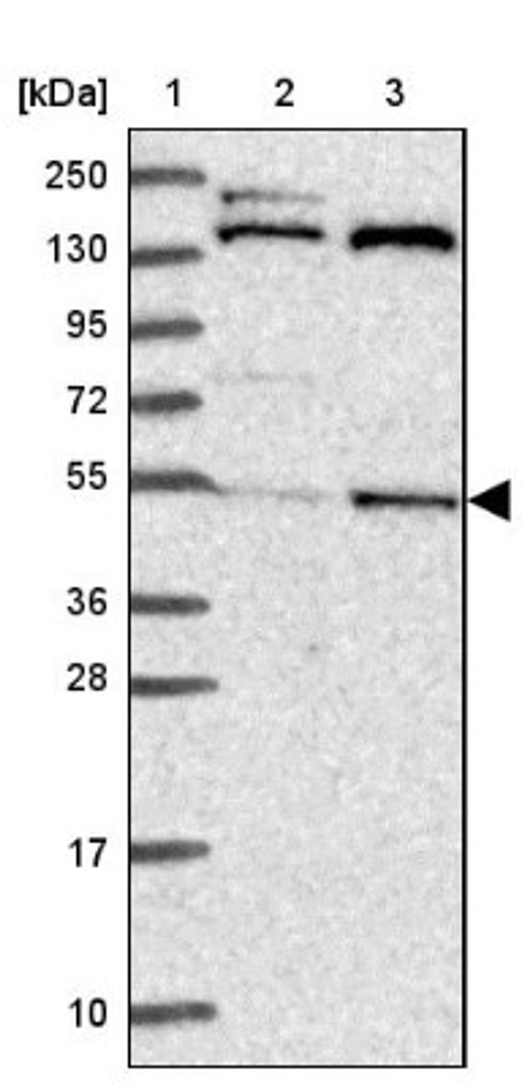 Western Blot: ATG16L2 Antibody [NBP2-14326] - Lane 1: Marker [kDa] 250, 130, 95, 72, 55, 36, 28, 17, 10<br/>Lane 2: Human cell line RT-4<br/>Lane 3: Human cell line U-251MG sp