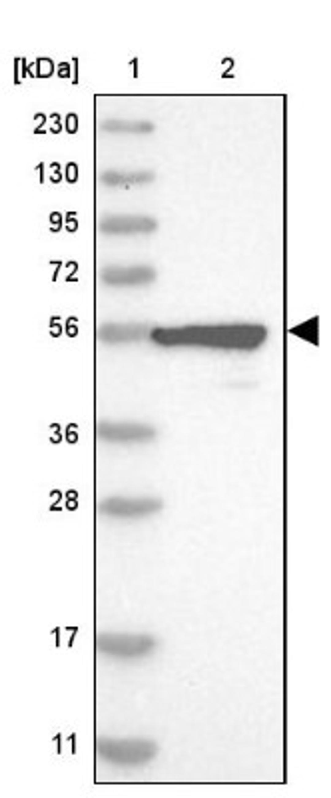 Western Blot: CRISPLD1 Antibody [NBP1-84413] - Lane 1: Marker [kDa] 230, 130, 95, 72, 56, 36, 28, 17, 11<br/>Lane 2: Human cell line RT-4